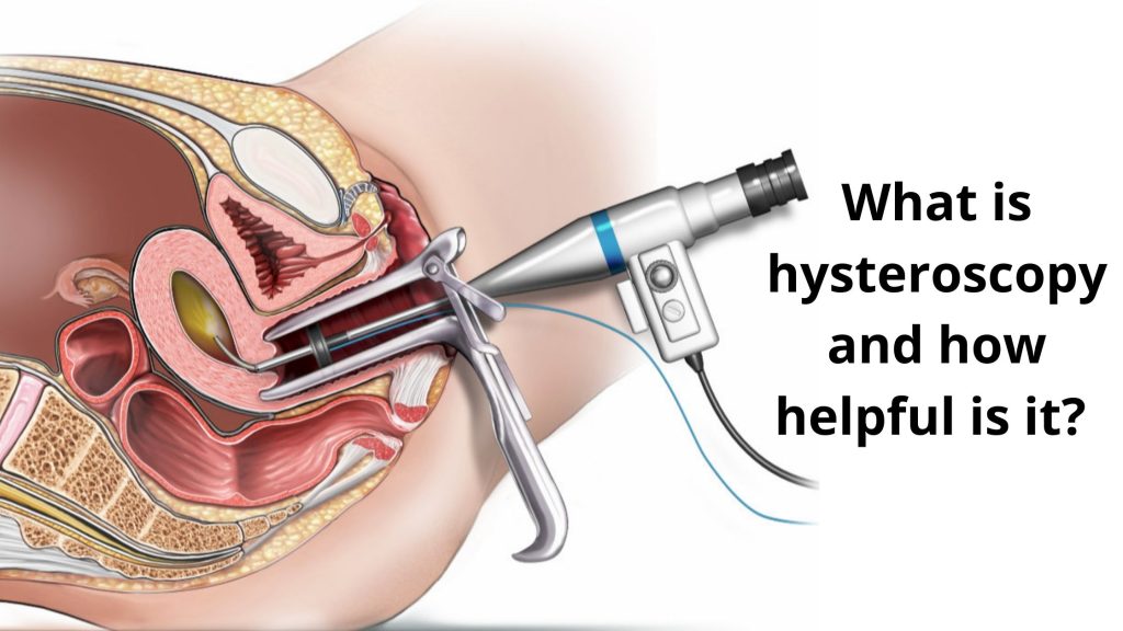 What is hysteroscopy and how helpful is it